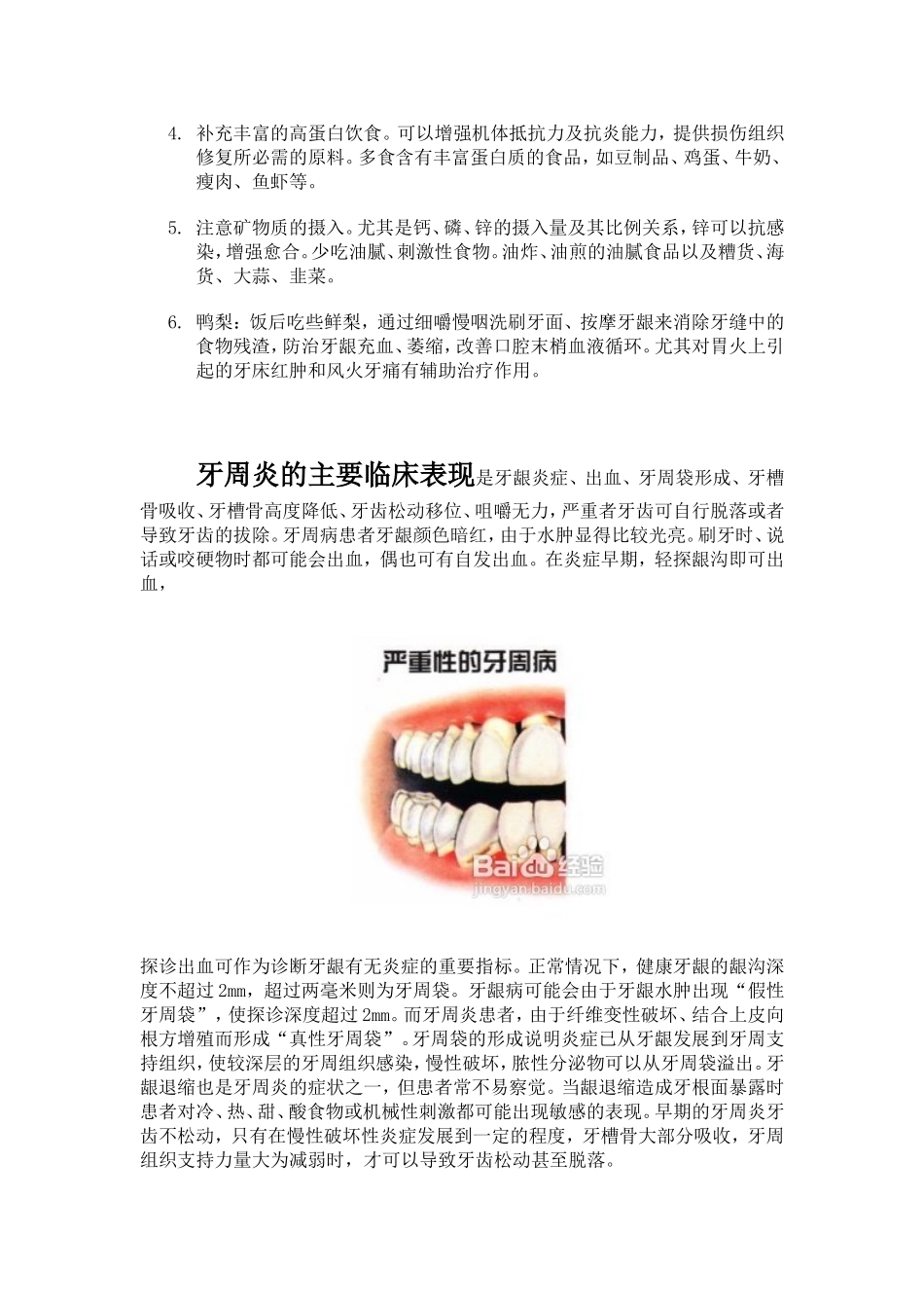 牙周病的治疗步骤_第3页