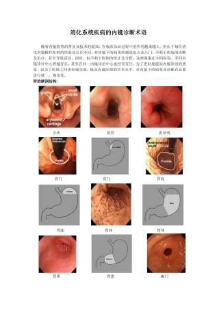 消化系统疾病的内镜诊断术语.ppt