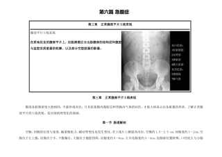 正常腹部平片X线表现