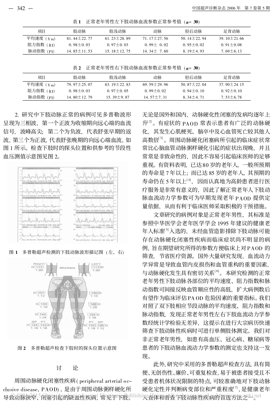 正常老年男性下肢动脉超声多普勒血流参数测定_第2页