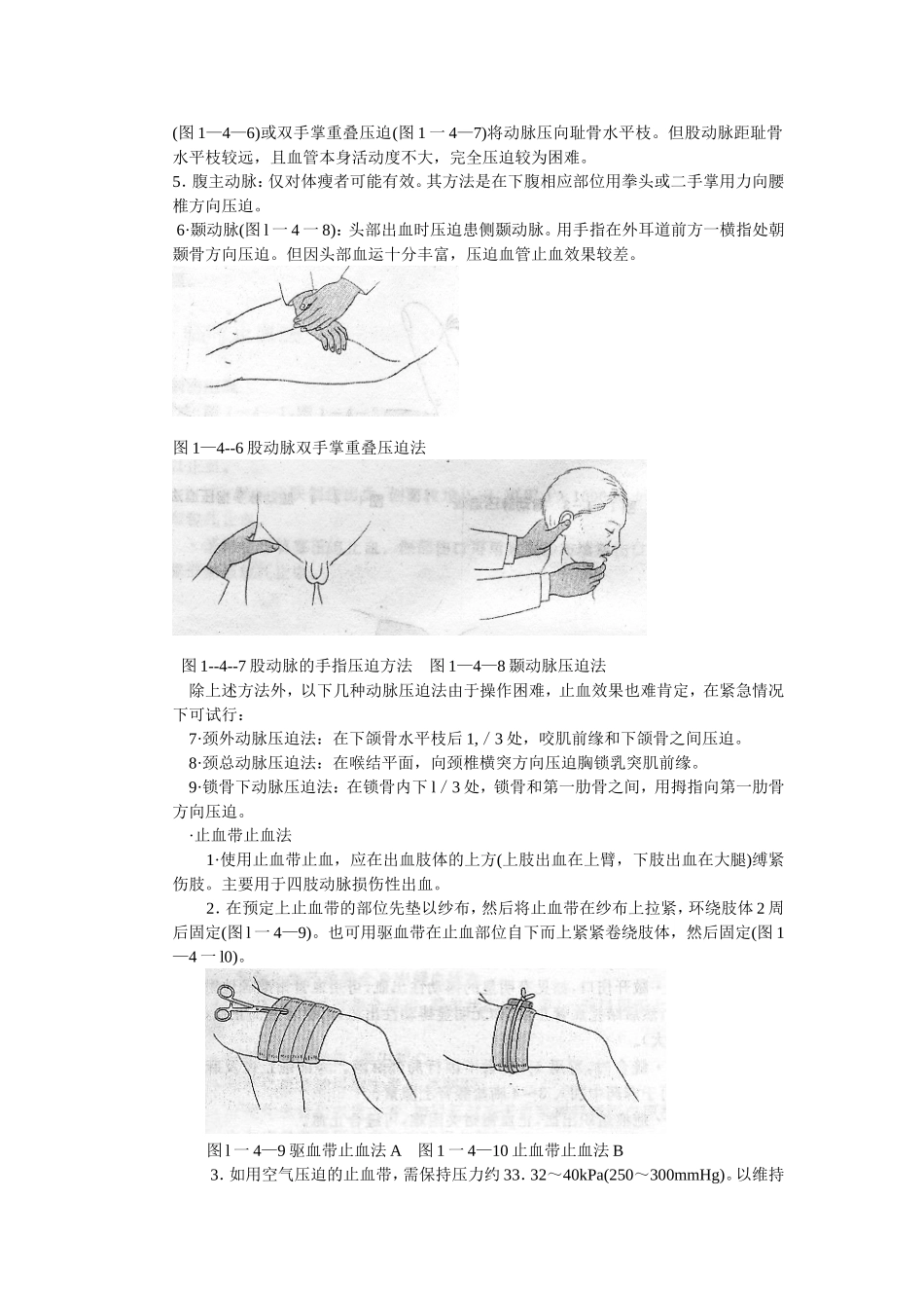 止血法 绷带包扎法2014_第2页