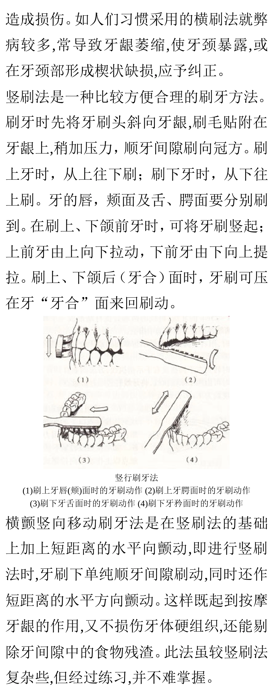 楔状缺损与正确刷牙方法@社区卫生教育_第2页