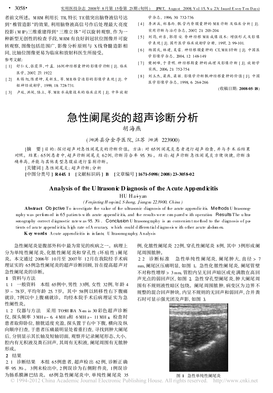 椎管外神经根囊肿MRI检查_第3页