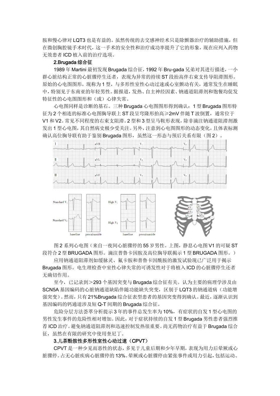 无明显心脏疾病的心脏骤停应考虑哪些情况？_第2页