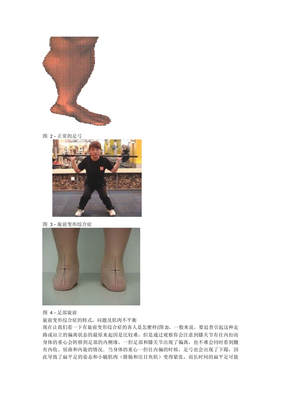 旋前变形综合症_第2页
