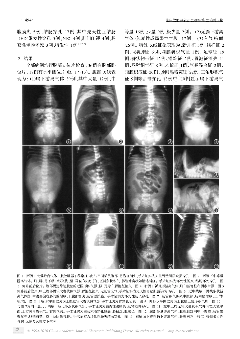 新生儿胃肠道穿孔的特殊X线征象及价值[1]_第2页