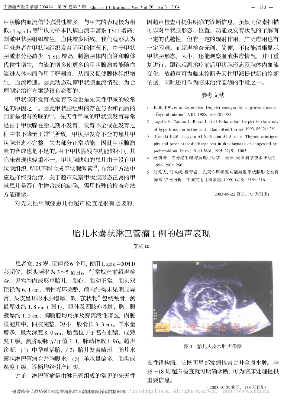 新生儿甲状腺功能减低症的超声诊断意义_赵亚平_第3页