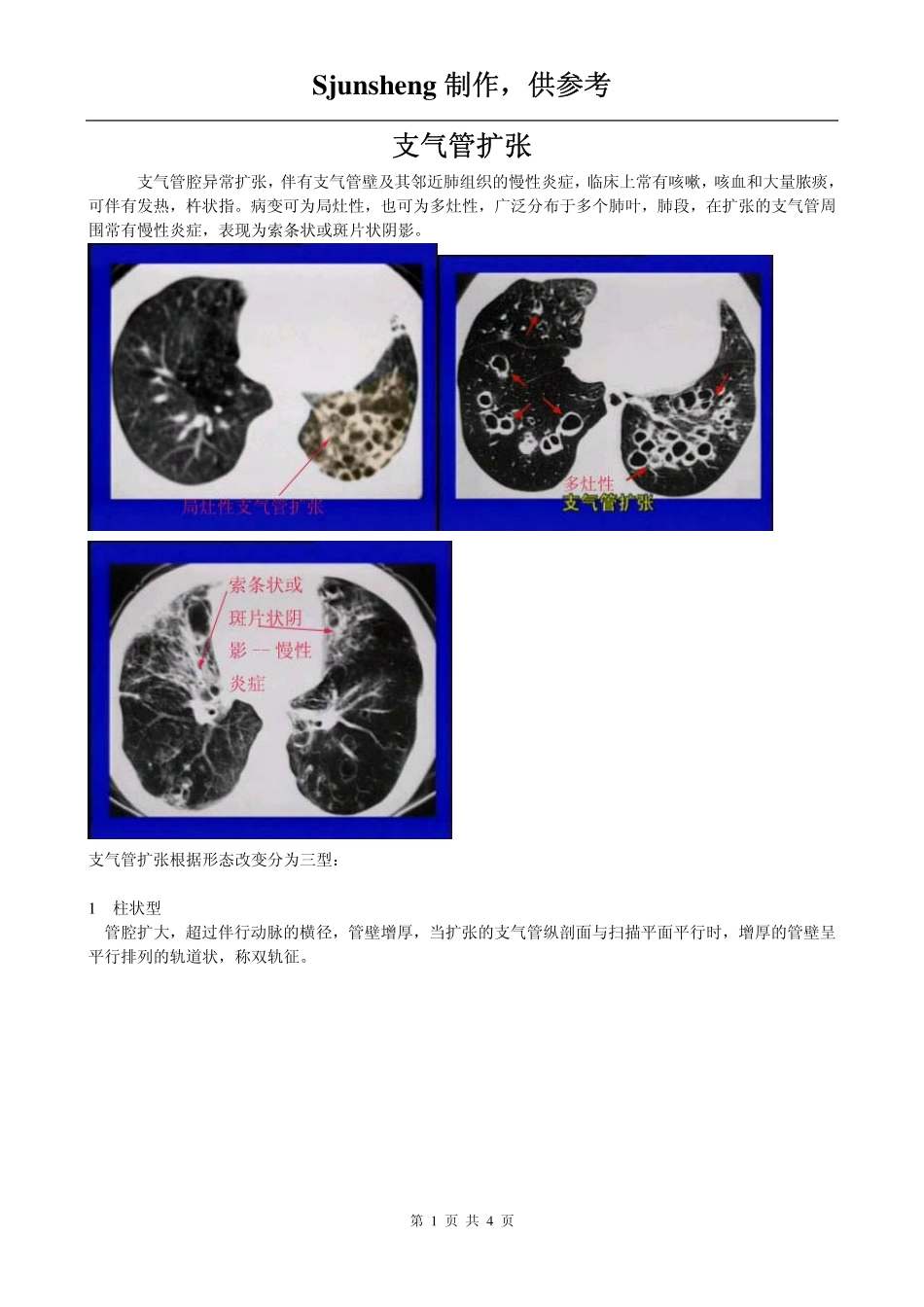支气管扩张的CT图像_第1页