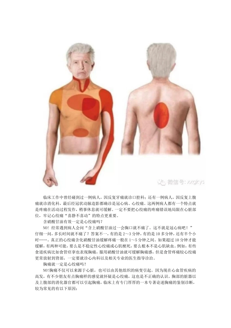 心绞痛知识大全_第3页