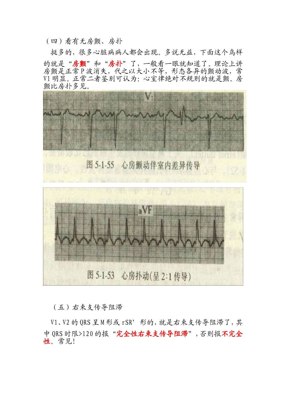 心电图阅读2_第1页