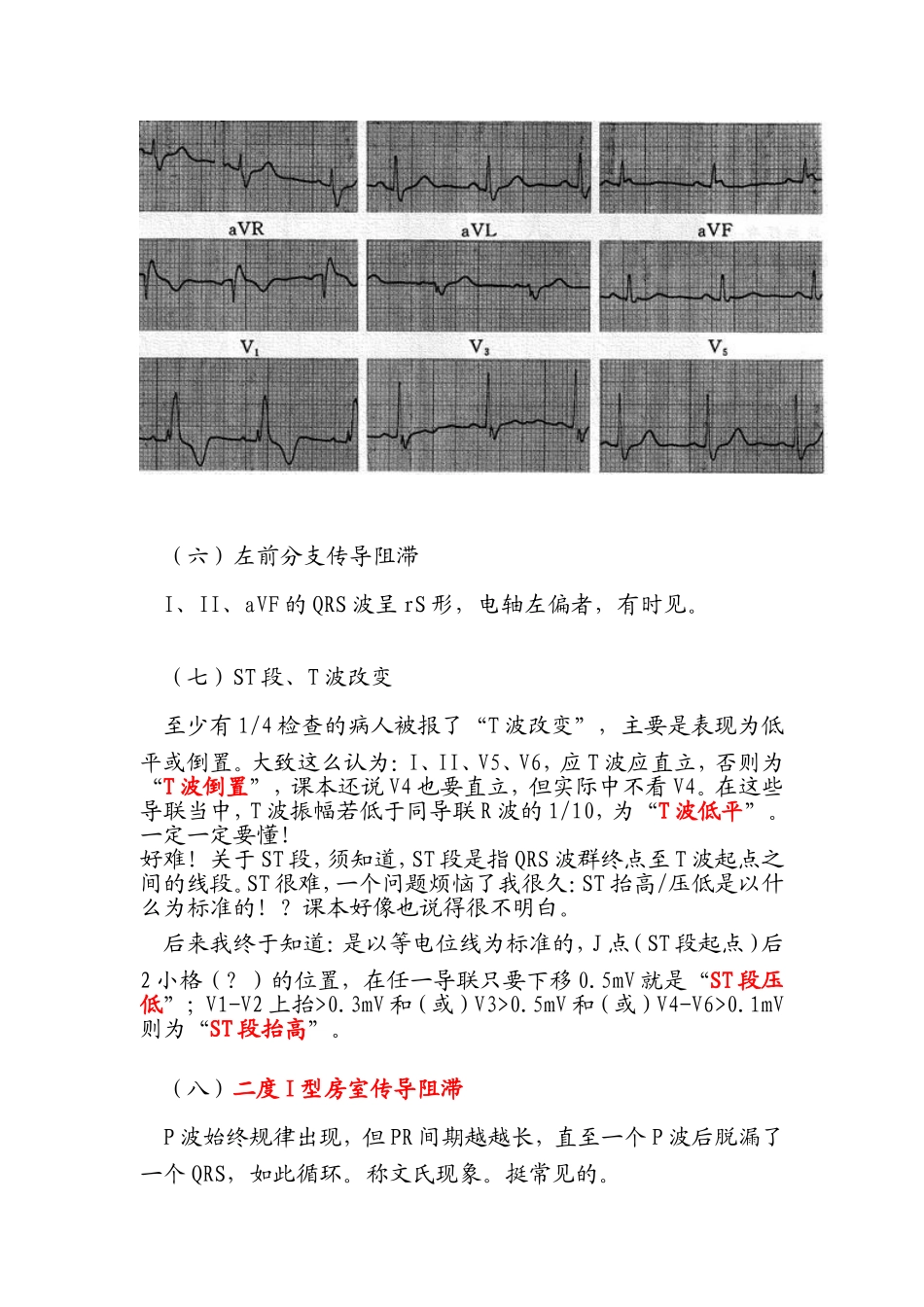 心电图阅读2_第2页