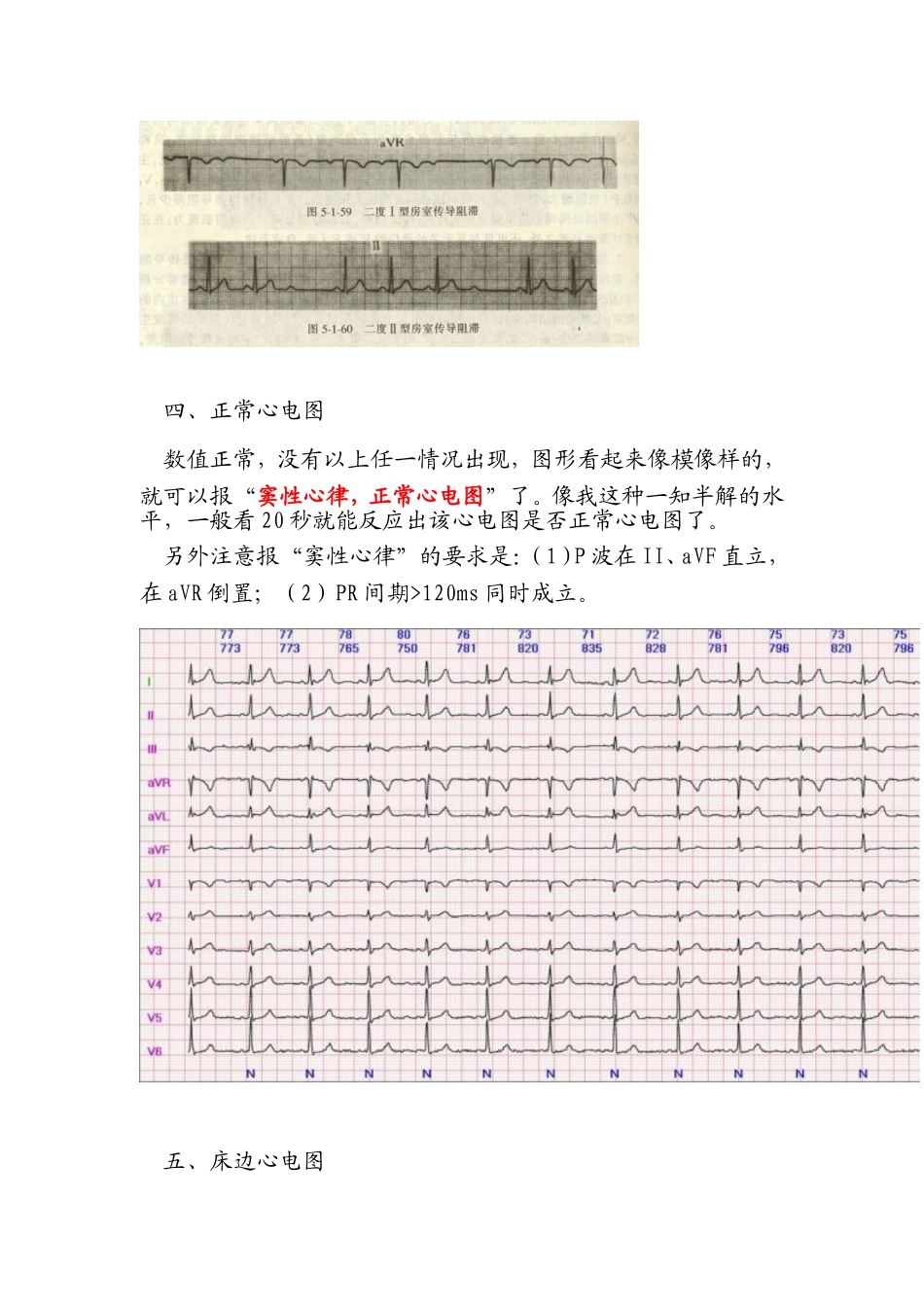 心电图阅读2_第3页