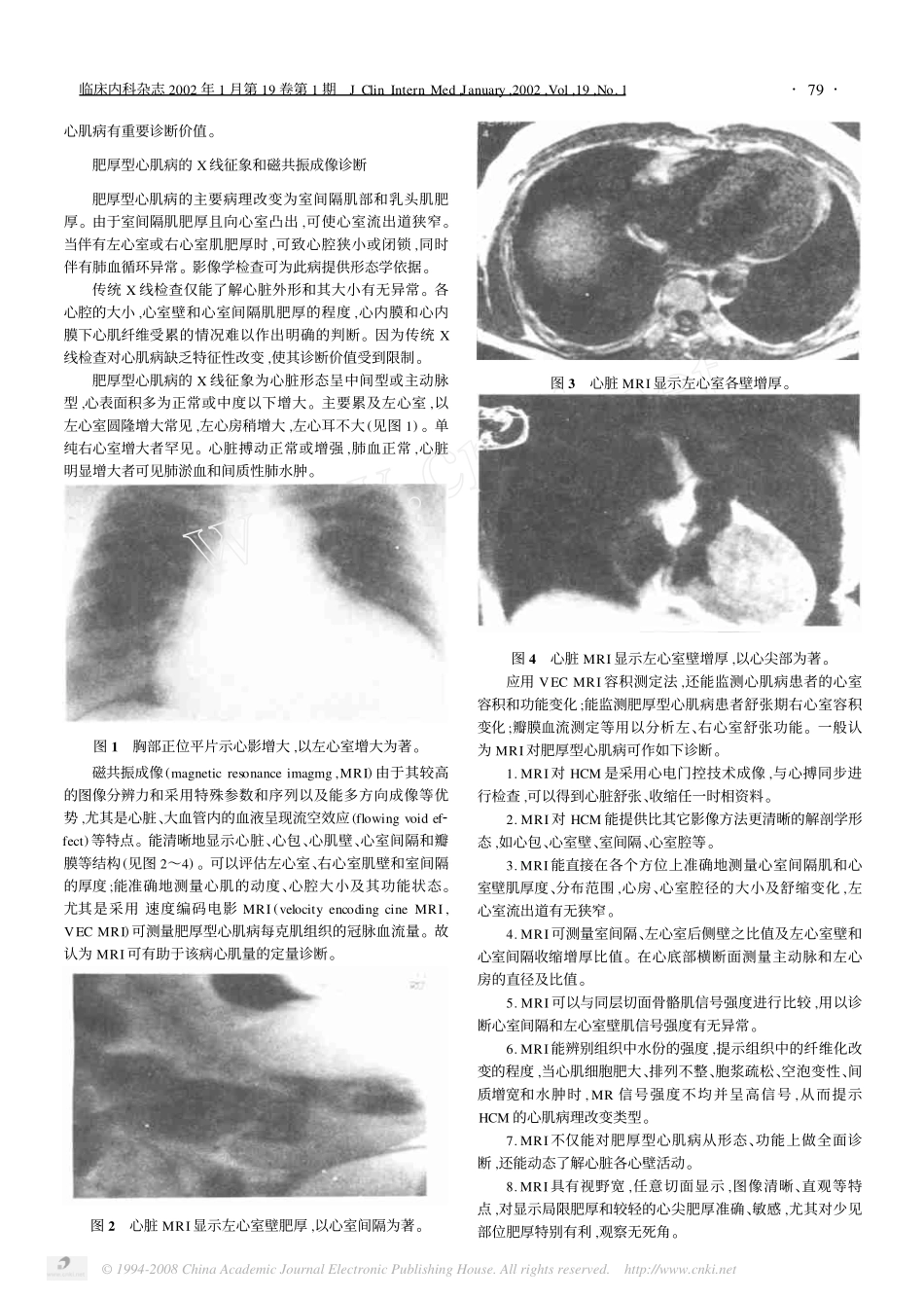 心电图超声心动图磁共振技术对肥厚型心肌病的诊断_第3页