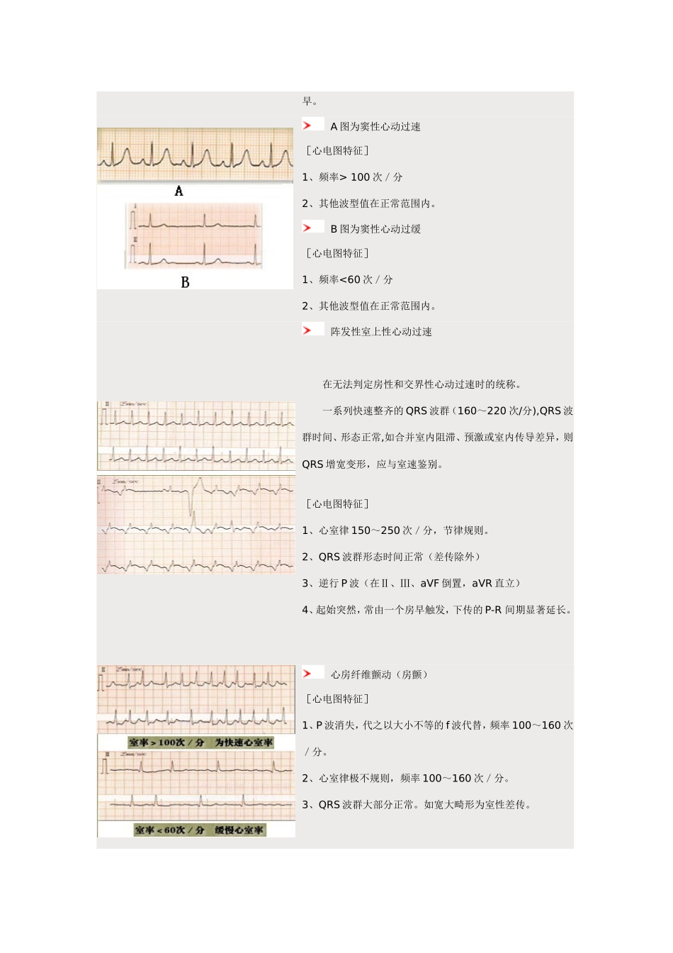 心电图图谱1_第2页