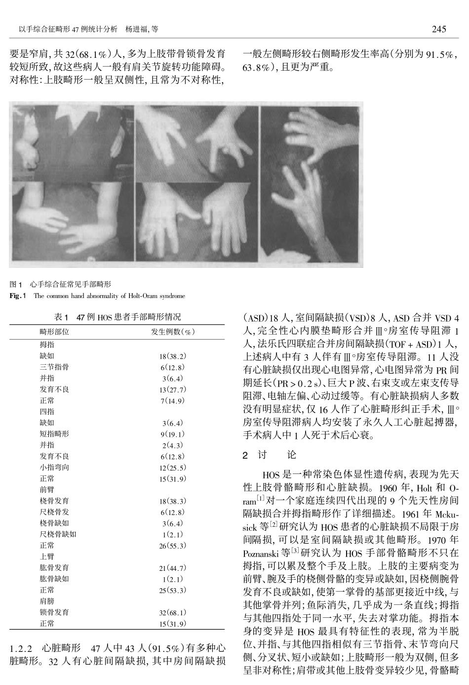 心手综合征畸形47例统计分析_第2页