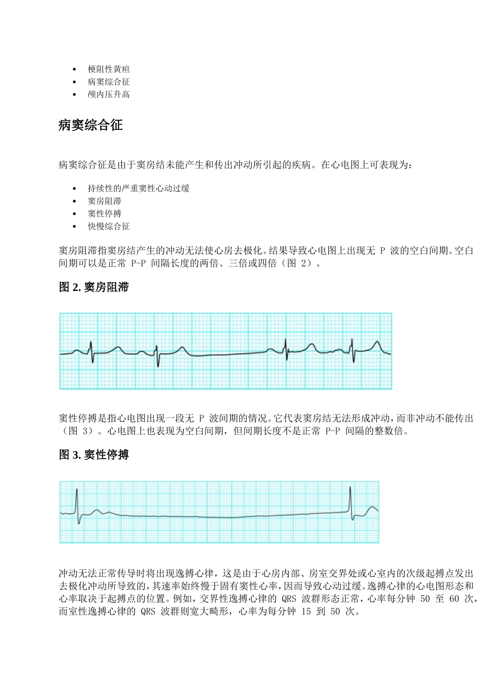 心动过缓：看图诊断_第3页