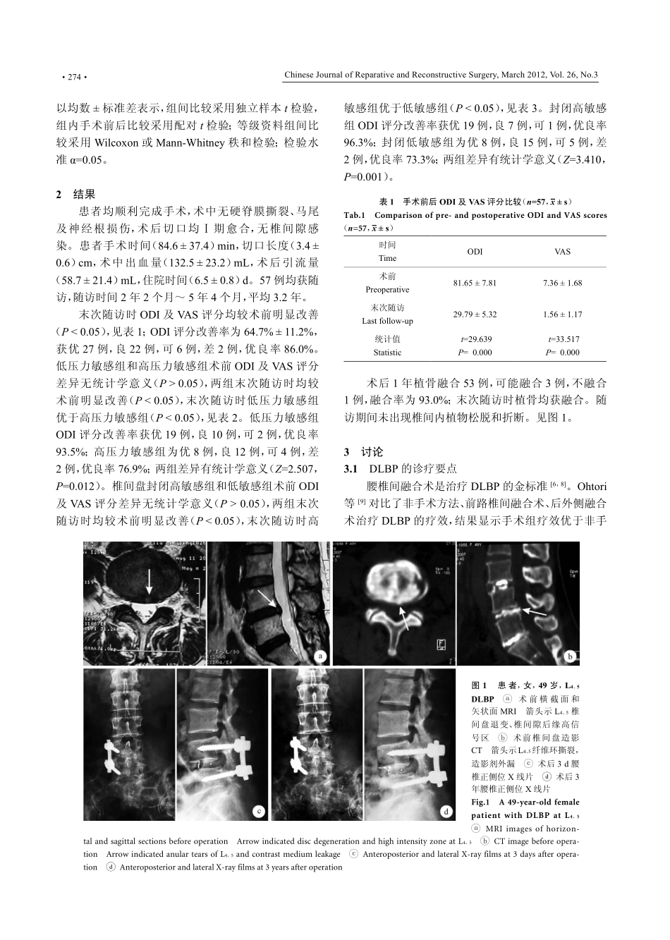微创经椎间孔椎体间融合联合单侧椎弓根螺钉固定术治疗椎间盘源性腰痛_第3页