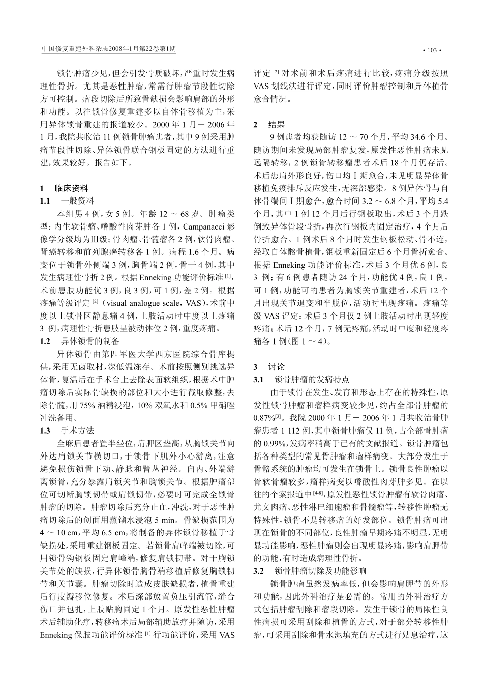 异体锁骨移植重建锁骨肿瘤切除后骨缺损_第2页