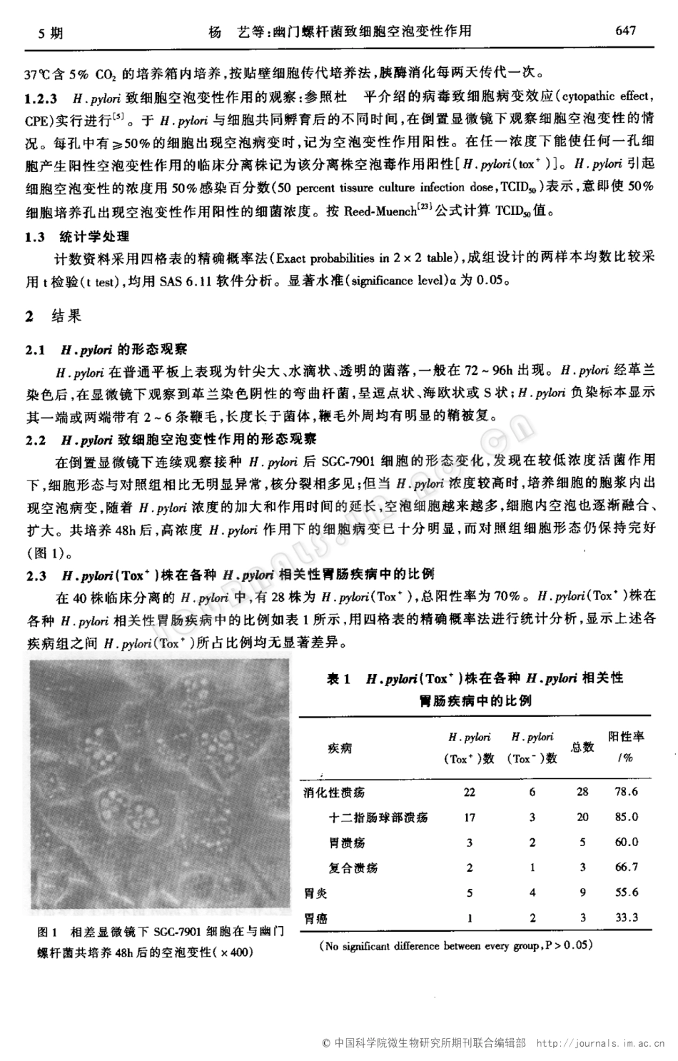 幽门螺杆菌致细胞空泡变性作用_第2页