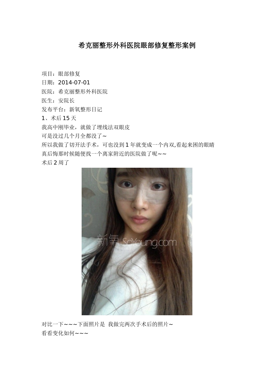 希克丽整形外科医院眼部修复整形案例_第1页