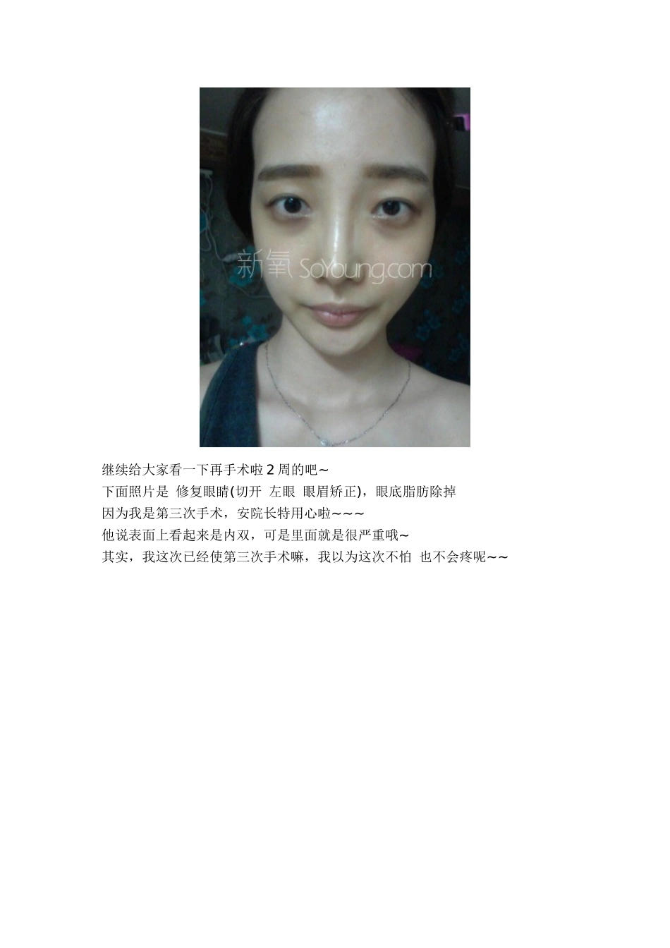 希克丽整形外科医院眼部修复整形案例_第2页