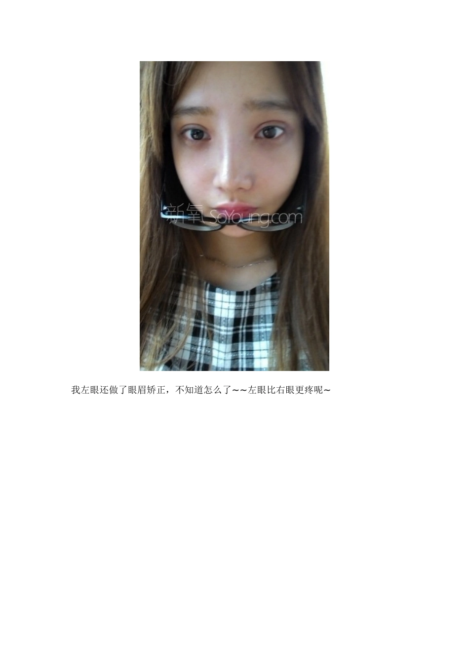 希克丽整形外科医院眼部修复整形案例_第3页