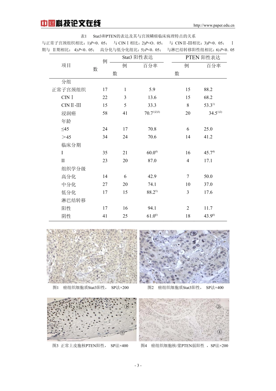 子宫颈鳞状细胞癌中Stat3和PTEN的表达及临床病理意义_第3页
