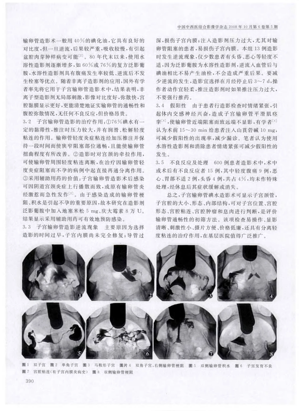 子宫输卵管造影对女性不孕症临床诊断的价值_第2页