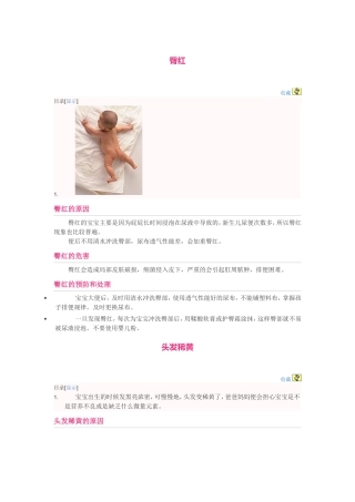 婴儿常见生理现象