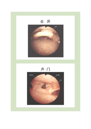 纤维支气管镜图谱讲解