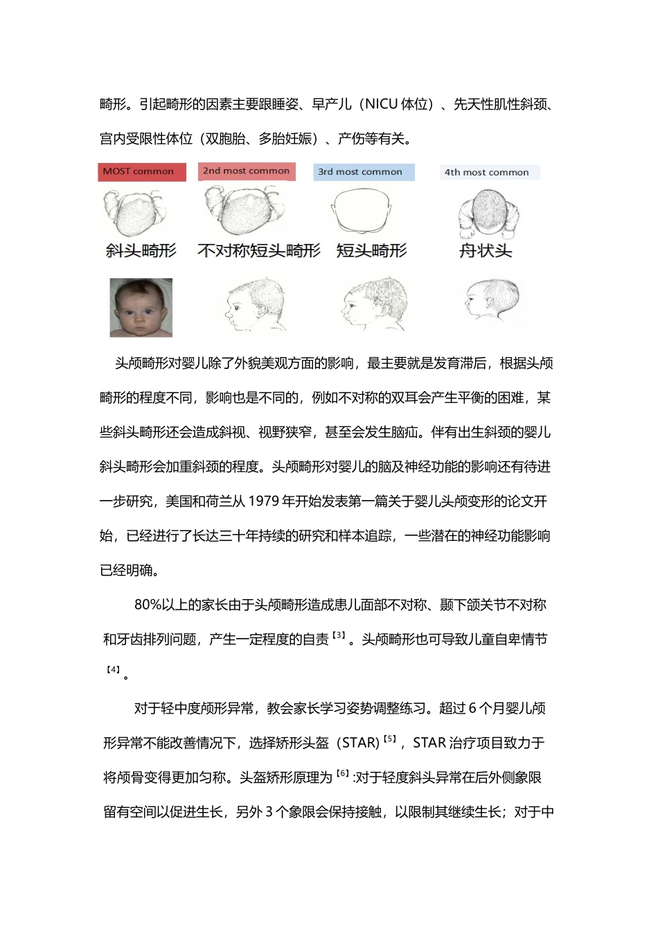 头颅畸形的危害和矫形头盔的作用_第2页