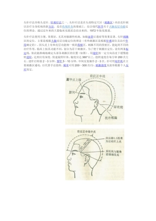 头针疗法亦称头皮针