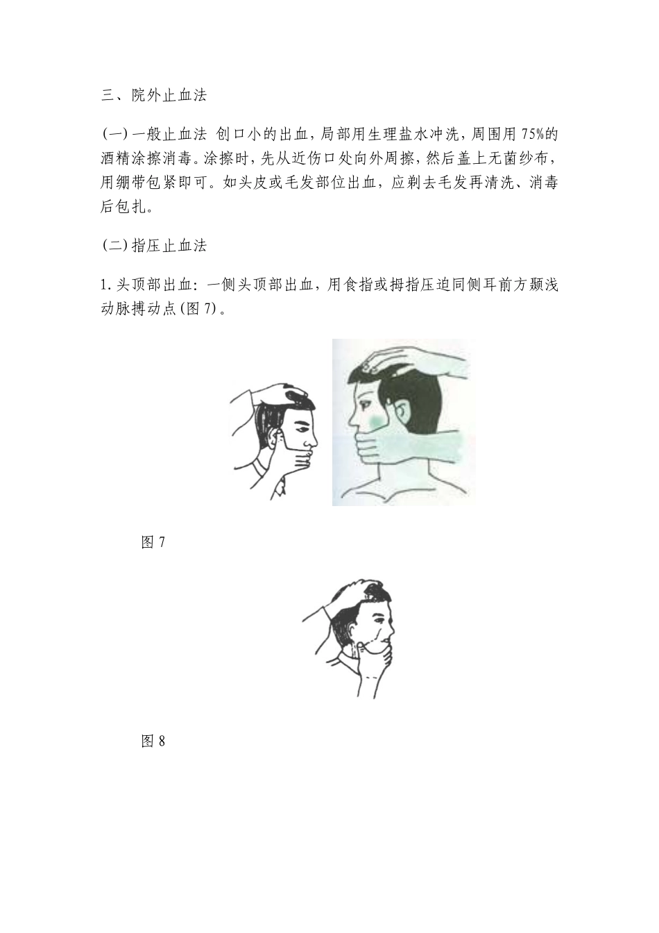 外伤出血急救_第2页