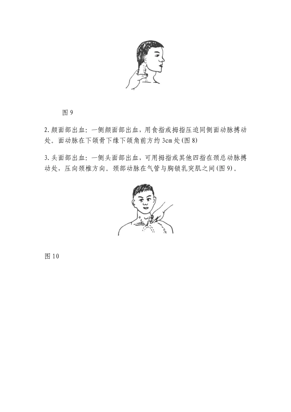 外伤出血急救_第3页