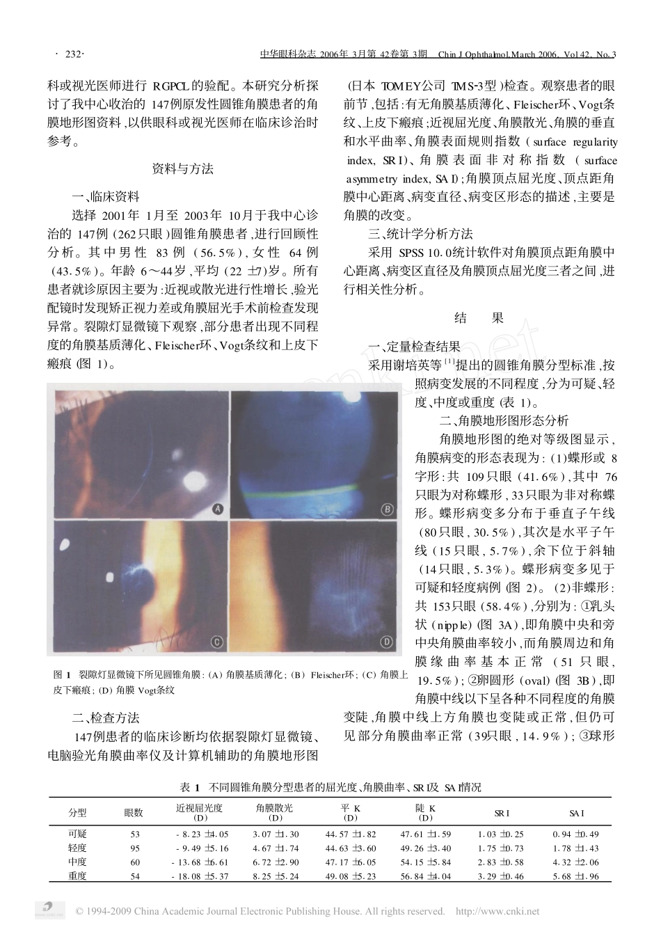 圆锥角膜的角膜地形图分析_第2页