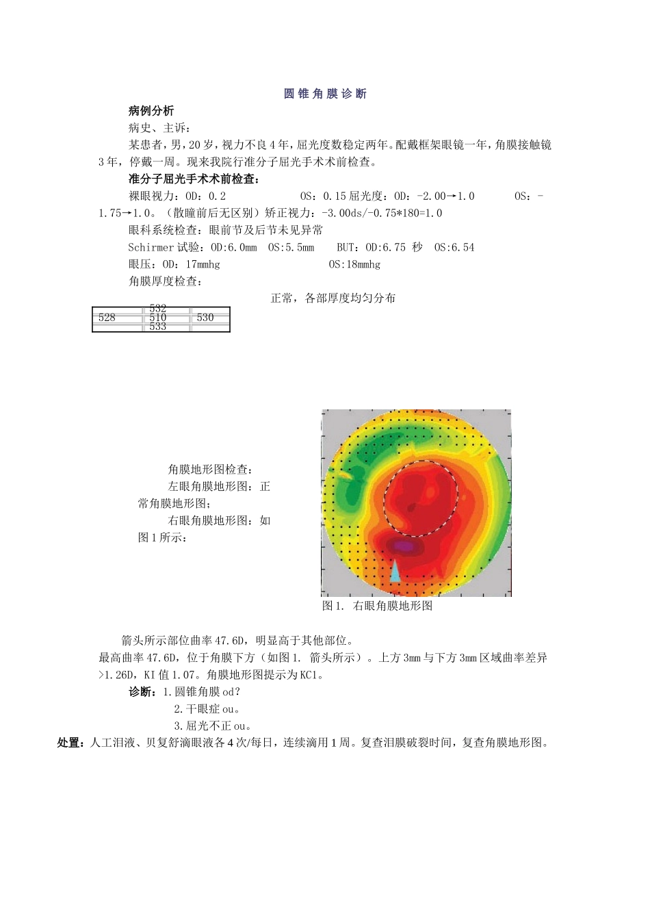 圆 锥 角 膜 诊 断 应 慎 重_第1页