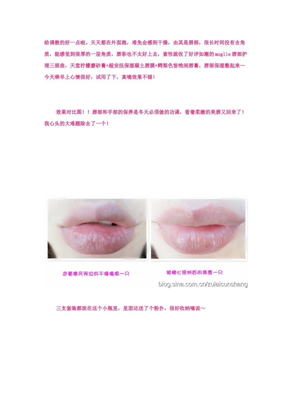 嘴唇干燥怎么办 求保湿滋润防干裂 唇部保养_第2页