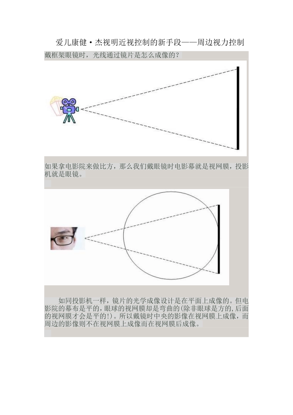 周边视力控制_第1页