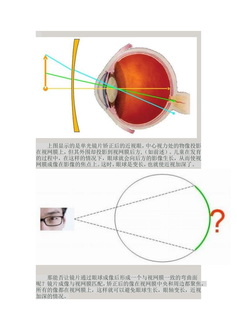 周边视力控制_第2页