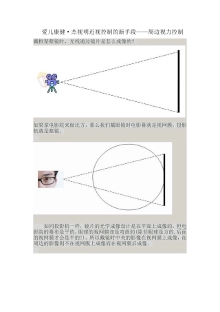 周边视力控制