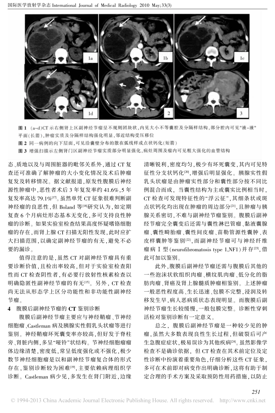 原发性腹膜后副神经节瘤的CT诊断与鉴别诊断_石士奎_第3页