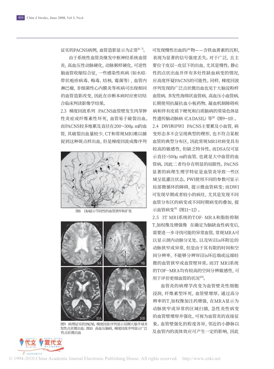 原发性中枢神经系统血管炎的诊断策略_张在强_第3页