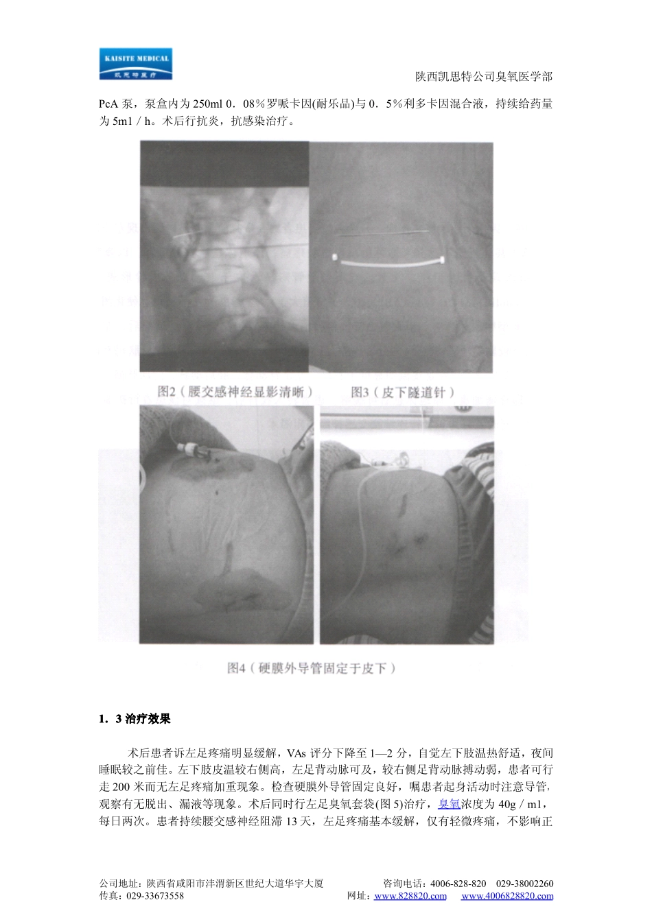 医用臭氧联合连续腰交感神经阻滞治疗慢性下肢缺血性疼痛的临床观察_第3页