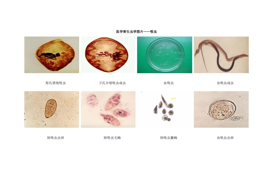 医学寄生虫学图片——吸虫_第1页