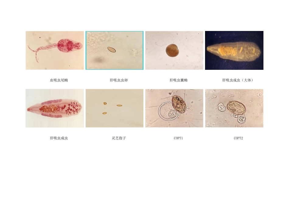 医学寄生虫学图片——吸虫_第2页