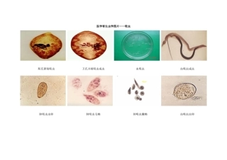 医学寄生虫学图片——吸虫