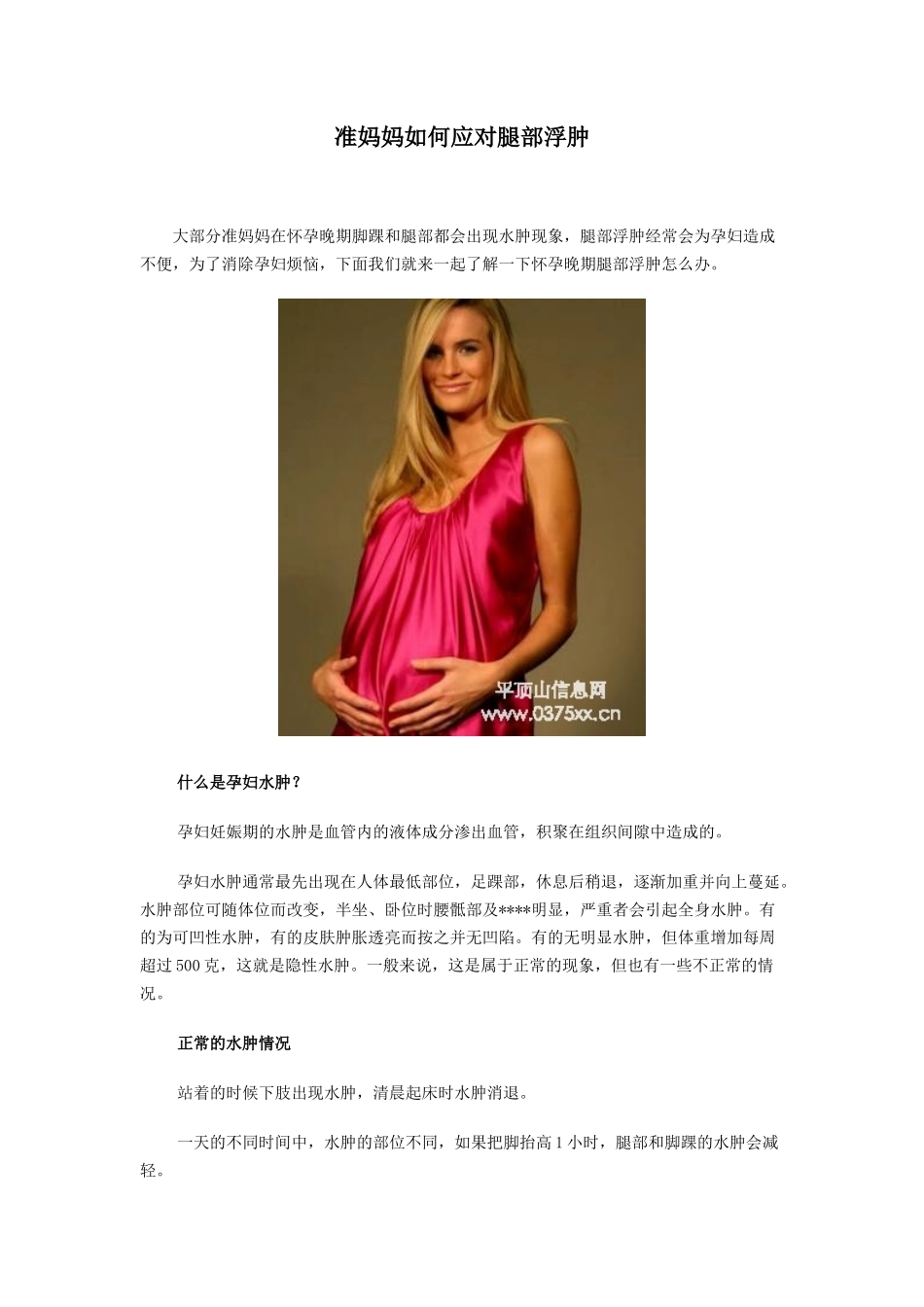 准妈妈如何应对腿部浮肿_第1页