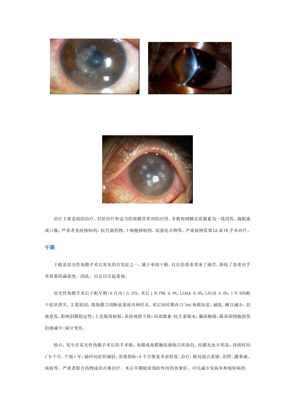 准分子激光屈光性角膜手术后角膜并发症_第3页