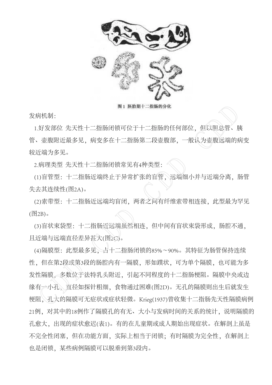 先天性十二指肠闭锁_第2页