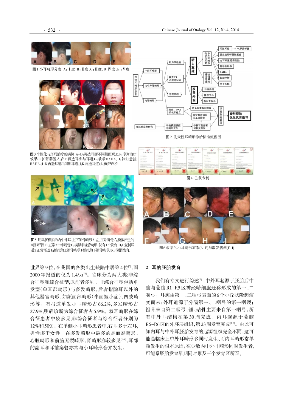 先天性中外耳畸形_第2页
